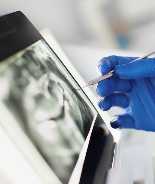 Dentist looking at digital dental x-rays on computer screen