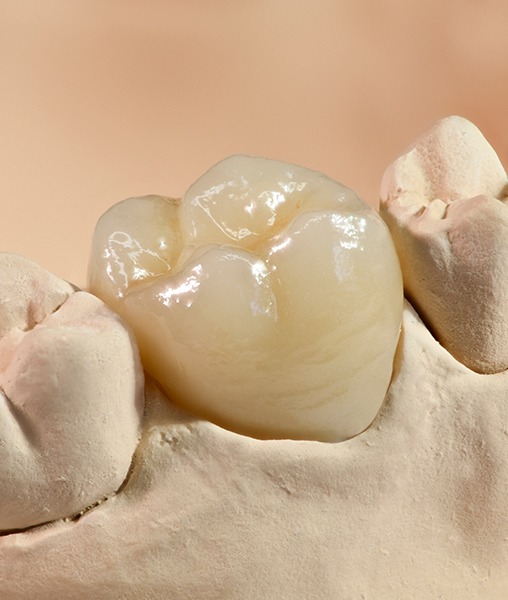 Model smile with dental crown restoration