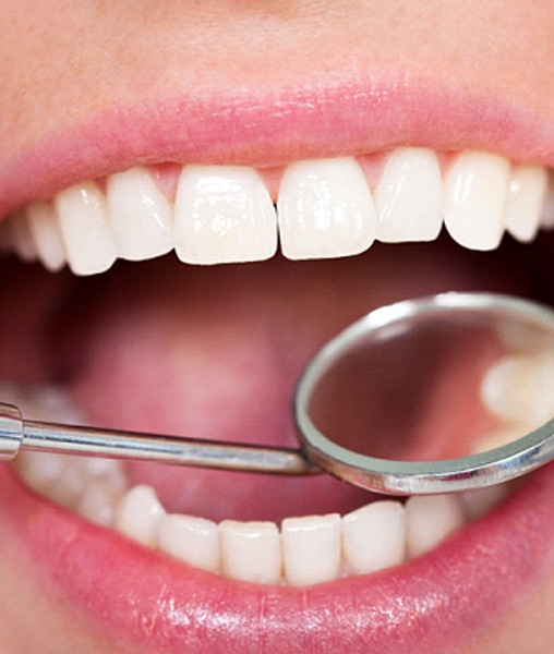 Close-up of woman’s mouth during checkups and cleanings in York