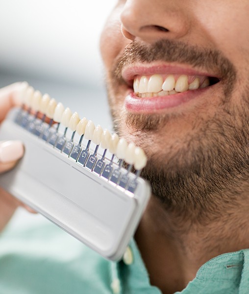 Smile compared with porcelain veneer shade chart