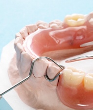 Closeup of partial dentures in York being made