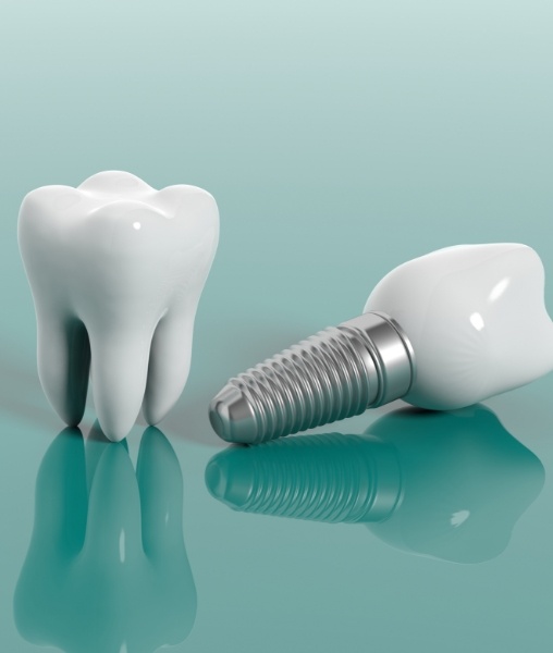 Animated natural tooth and dental implant supported replacement tooth