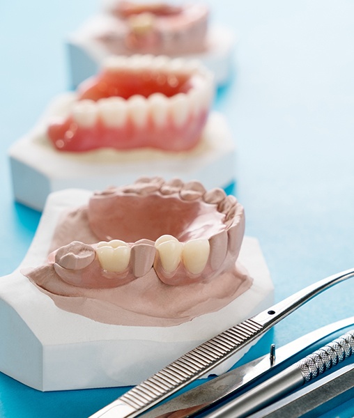 Partial and full dentures on smile model