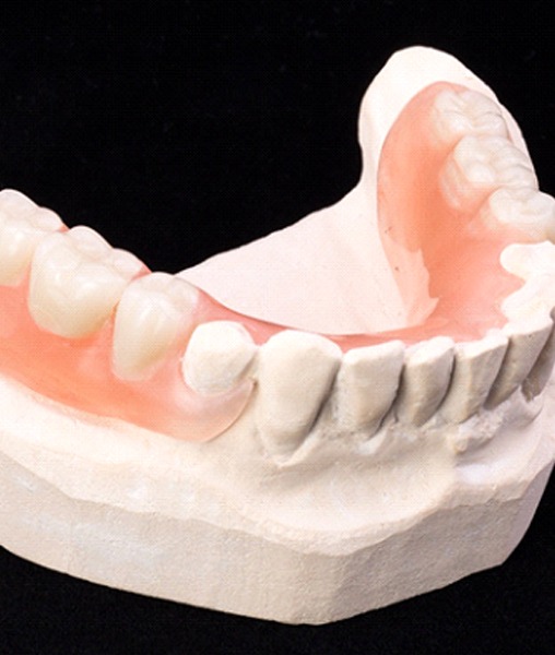 Partial denture on dental model against black background