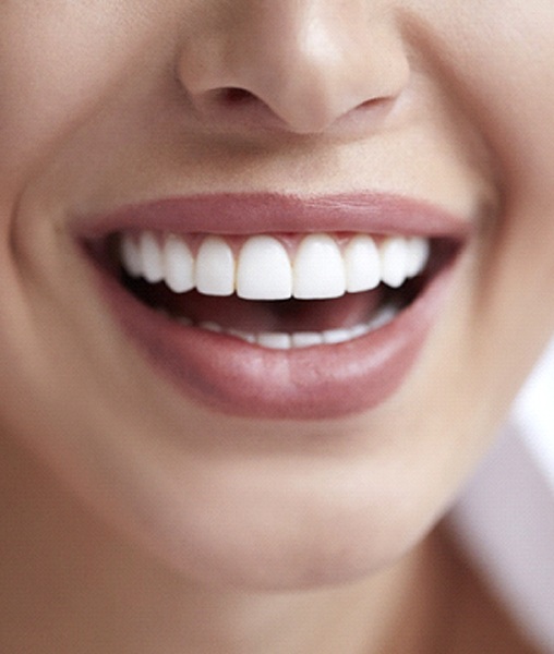 Close-up of smile with tooth-colored fillings in York