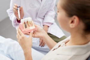 holding dental implant model 