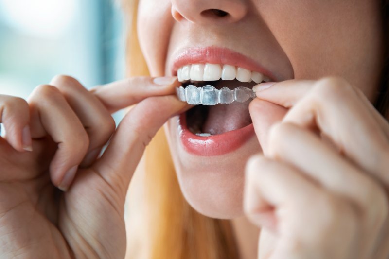 Young woman wearing her Invisalign