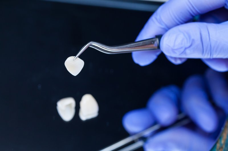 A dentist holding veneers with tweezers